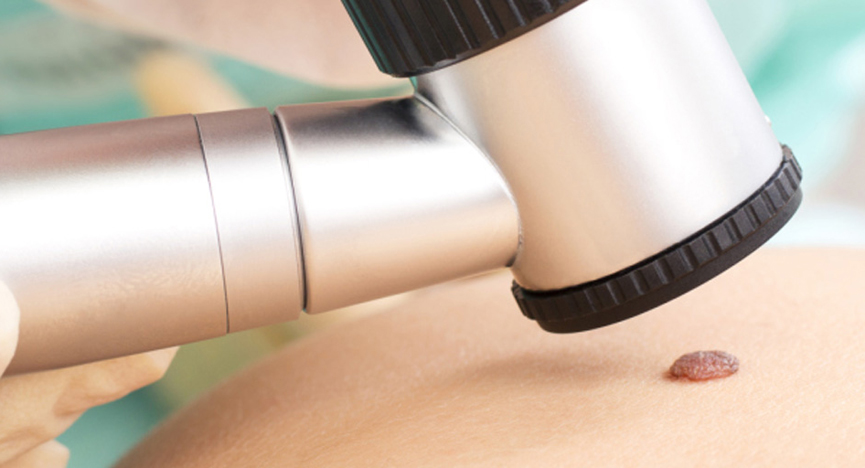 mappatura neo a Grottaglie