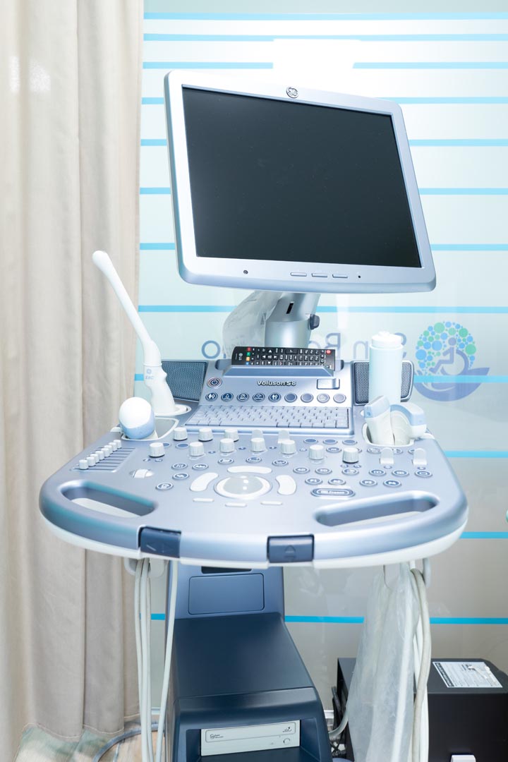 ecografo 4d per ginecologia