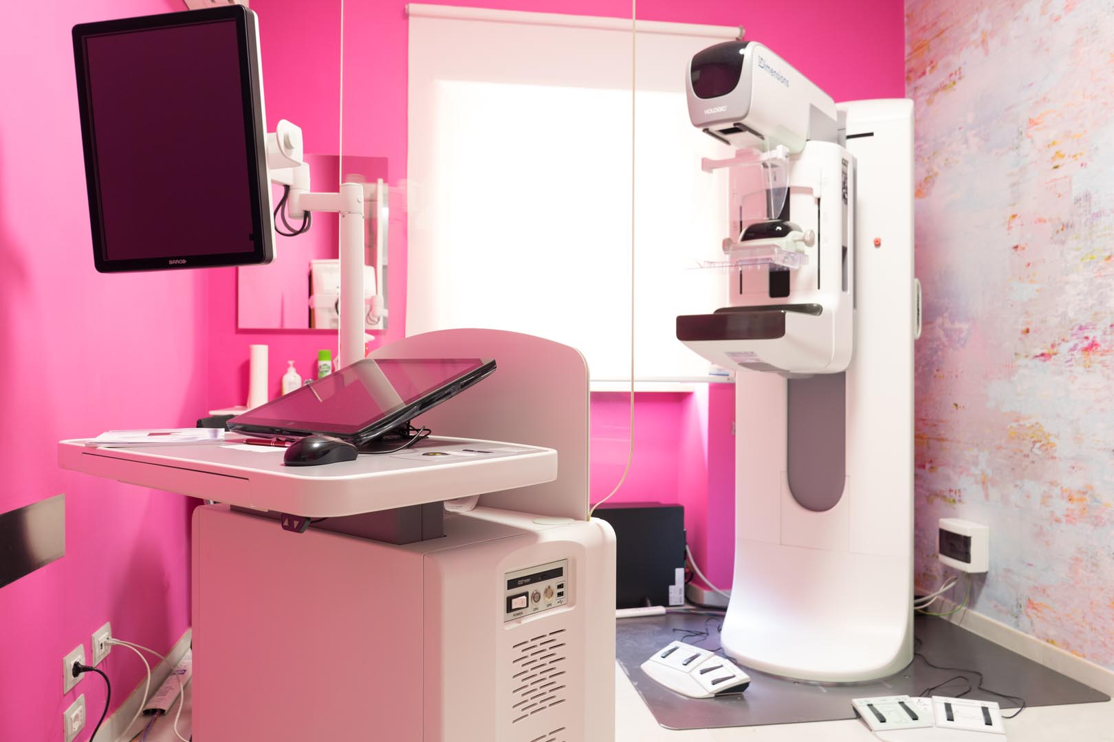 tomosintesi 3d senza radiazioni