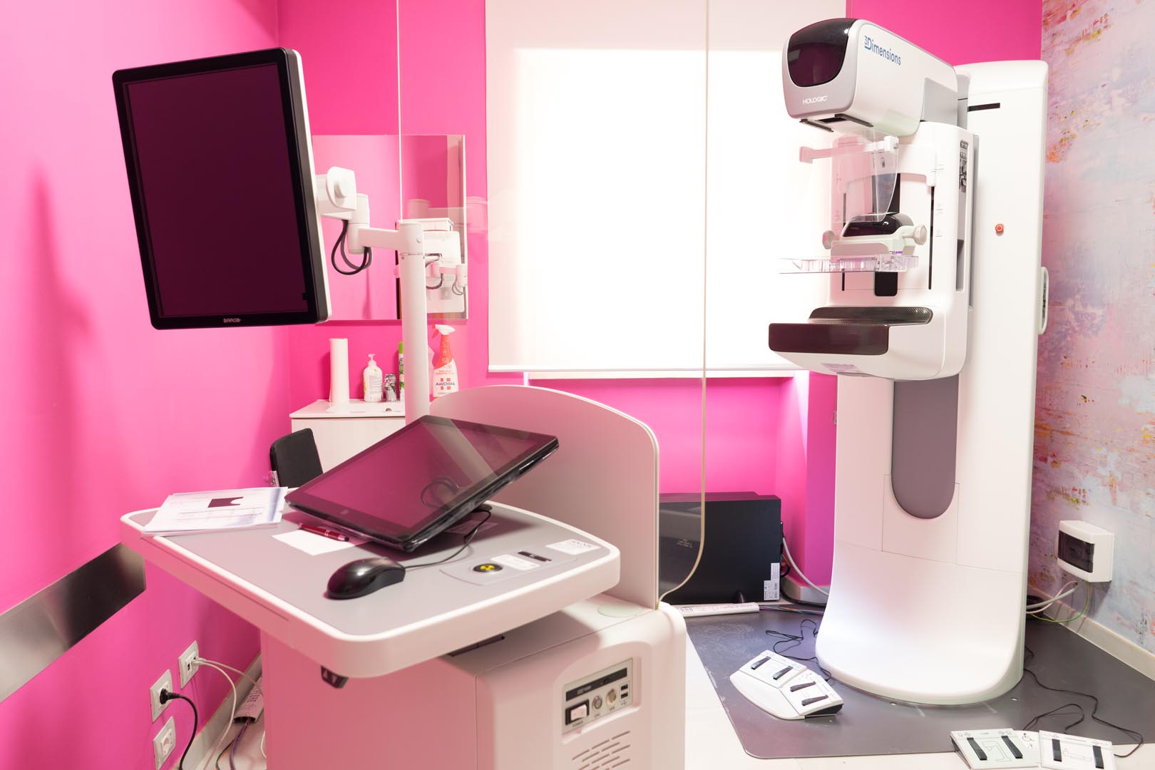 tomosisntesi 3d senza radiazioni2